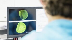 Virtual infection model is generated on the computer.