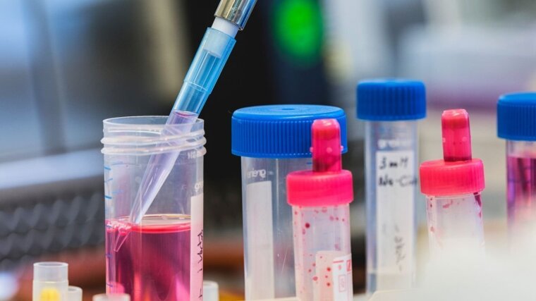 Sample is pipetted.