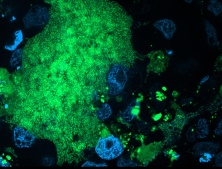 Infection of host cells by Vibrio cholerae