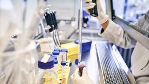 Analyze immune cells isolated from blood.
