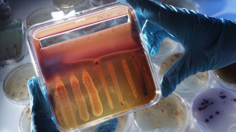 Diffusion assay with several Streptomyces lividans transformants.