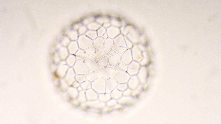 Microphotograph of a radiolarian