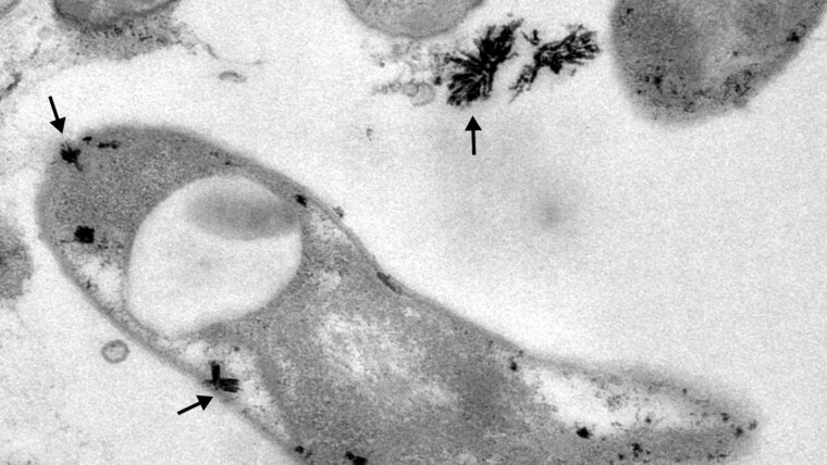 Intracellular lanthanide deposits in Beijerinckiaceae bacterium RH AL1.