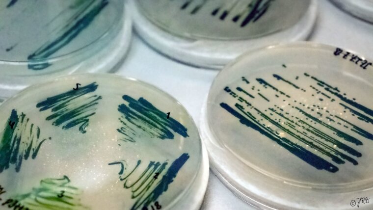 Agarplatten Cyanobakterien