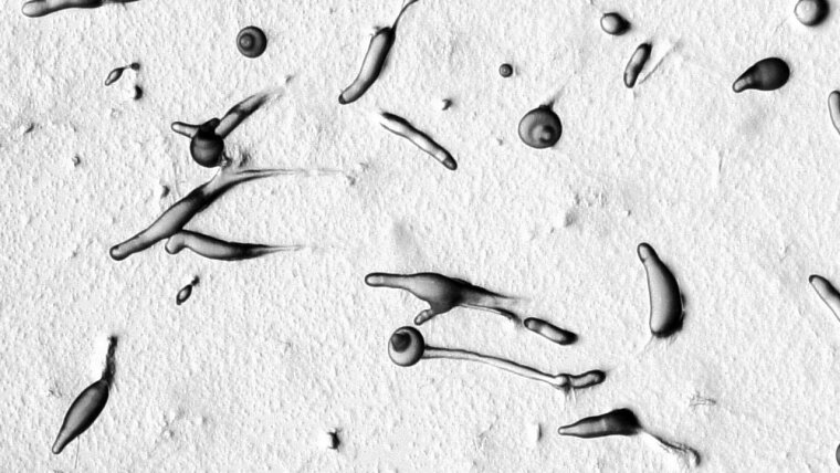multicellular development of Dictyostelium discoideum